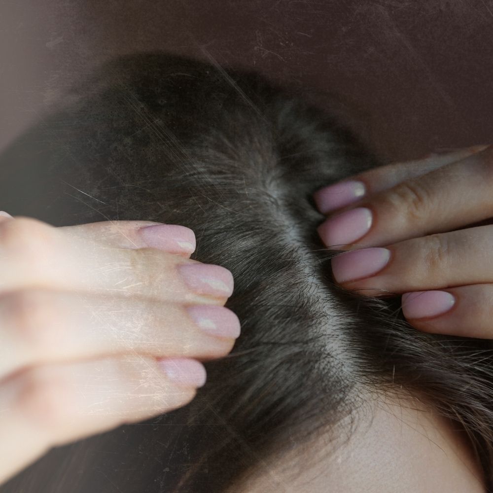 the top of a lady's head, she has dark hair her hands are pulling apart her parting to show a little of her scalp her fingernails are painted pale pink this image depicts how apple cider vinegar can be used to treat an itchy scalp