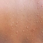 A picture of healthy skin detailing the waterproof nature of an intact skin barrier