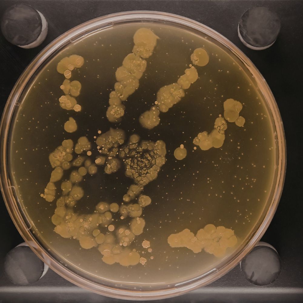 a handprint of bacteria growing in a petri dish